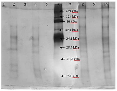 Production of an Enzymatic Extract From Aspergillus oryzae DIA-MF to Improve the Fructooligosaccharides Profile of Aguamiel